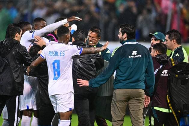 Fußball, CONCACAF Nations League, Mexikos Trainer Javier Aguirre durch Wurfgeschoss verletzt RECORD DATE NOT STATED IV CONCACAF NATIONS LEAGUE 2024-2025 Honduras 2-0 Mexico Javier Aguirre head coach of Mexico has blood on his head due to an attack by Honduras fans during the Quarterfinals first leg match between Honduras and Mexican national team, Nationalteam (Mexico) as part of the Concacaf Nations League 2024-2025 at Francisco Morazan Stadium on November 15, 2024 in San Pedro Sula, Honduras. SAN PEDRO SULA HONDURAS HONDURAS  Copyright: xAdrianxMaciasx 20241115221241_CNL_CFI_HON_MEX_AGUIRRE170