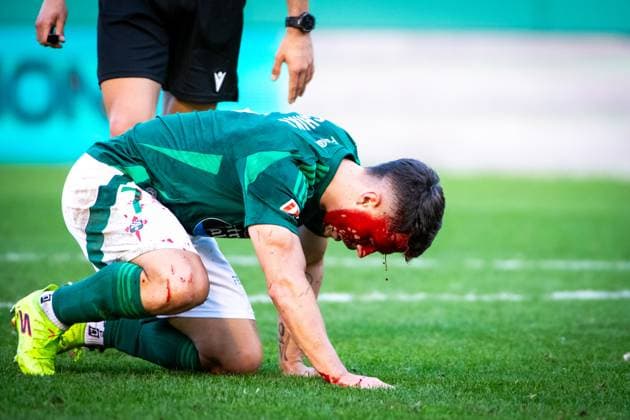 Bilder des Jahres 2024, Sport 12 Dezember Sport Themen der Woche KW 49 Sport Bilder des Tages Ferrol, Spain. 08 December, 2024. Liga Hypermotion, Racing Club Ferrol vs Real Oviedo. Chiki bleeding in the rival area after a penalty. Ismael Mijan Alamy Live News Ferrol A Coruna Spain Copyright: xIsmaelxMijanx