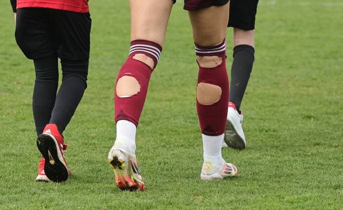 23 03 2025 Soccer Season 2024 2025 2 Women Soccer Bundesliga 19 Matchday 1 FC Nuremberg FCN Club Clubfrauen VfL Bochum Sportfoto Zink DaMa xdaxmax Medina Desic 10, 1 FC Nuremberg FCN has socks cut in