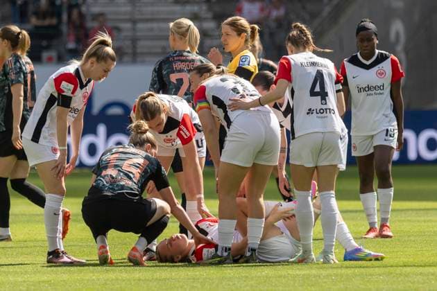 Google Pixel Womens Bundesliga Eintracht Frankfurt FC Bayern Munich, 12 04 2025 Jella Veit Eintracht Frankfurt 25 injured at Boiden, Eintracht Frankfurt FC Bayern Munich, Frankfurt, Deutsche Bank Park, 12 4 2025 Copyright: xBEAUTIFULxSPORTS Gawlikx