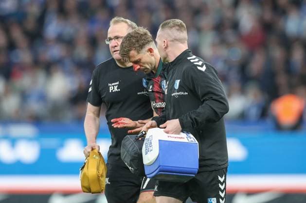 25 04 2025, xtgx, Soccer 2 Bundesliga, Hertha BSC Berlin 1 FC Magdeburg emspor, v l Alexander Nollenberger Magdeburg, 17 is injured on the nose, injury DFL DFB REGULATIONS PROHIBIT ANY USE OF PHOTOGRAPHS as IMAGE SEQUENCES and or QUASI VIDEO Berlin