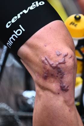 Super 8 Classic 2025 Cycling Race HAACHT, BELGIUM - SEPTEMBER 20 : Illustration picture shows the knee of Van Aert Wout (BEL) of Team Visma - Lease a Bike during the 27th edition of Super 8 Classic an UCI ProSeries 1.Pro one day cycling road race for Men Elite of 198.9 km with start in Brakel and finish in Haacht on September 20, 2025 in Haacht, Belgium, 20 09 2025 ( Motordriver Rodrique Verfaillie - Haacht Belgium  Copyright: xGvgx