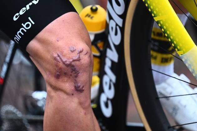 Super 8 Classic 2025 Cycling Race HAACHT, BELGIUM - SEPTEMBER 20 : Illustration picture shows the knee of Van Aert Wout (BEL) of Team Visma - Lease a Bike during the 27th edition of Super 8 Classic an UCI ProSeries 1.Pro one day cycling road race for Men Elite of 198.9 km with start in Brakel and finish in Haacht on September 20, 2025 in Haacht, Belgium, 20 09 2025 ( Motordriver Rodrique Verfaillie - Haacht Belgium  Copyright: xGvgx