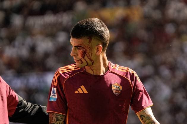 CALCIO - Serie A - AS Roma vs Hellas Verona FC Gianluca Mancini injured during the 5th day of the Serie A Championship between A.S. Roma vs Hellas Verona F.C. at the Olympic Stadium, Rome, italy on 28 September 2025 Rome Italy  Copyright: xIPAxSport ABACAx