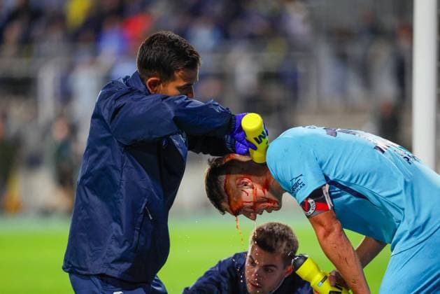 Attendants treat the wound of Christoph Greger 15, FC Viktoria Köln during the match between TSV 1860 München v FC Viktoria Köln, Football, Men, 3 League, 2025 2026, Matchday 9 on 01 10 2025 in Munich, Stadion a d Grünwalder Straße Bayern Germany