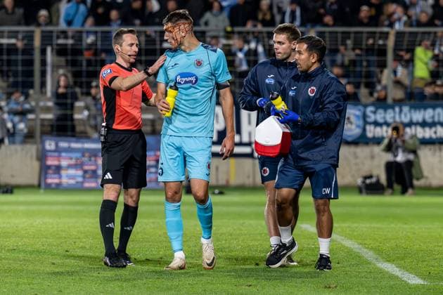 Lukas Benen Referee and the coaches take care ofChristoph Greger FC Viktoria Koeln, 15 , who is bleeding heavily after a collision with Eduardo Dos Santos Haesler Dudu Goalkeeper, FC Viktoria Koeln, 1 not in picture GER, TSV 1860 Muenchen vs Viktoria Koeln 1904, Football, 3 Bundesliga, Matchday 9, Season 2025 2026, 01 10 2025 DFL DFB REGULATIONS PROHIBIT ANY USE OF PHOTOGRAPHS as IMAGE SEQUENCES and or QUASI VIDEO GER, TSV 1860 Muenchen vs Viktoria Koeln 1904, Football, 3 Bundesliga, Matchday 9, Season 2025 2026, 01 10 2025 Muenchen Copyright: xEibner-Pressefoto HeikexFeinerx EP_HFR