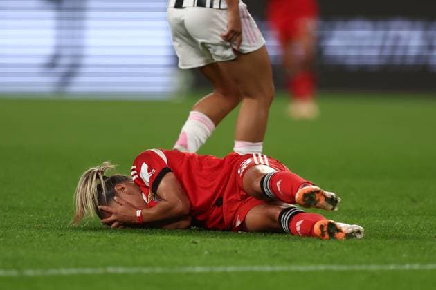 Juventus Fc v SL Benfica- UEFA Womens Champions League 2025 26 League Phase MD1 Anna Gasper of SL Benfica lies on the ground during the UEFA Womens Champions League Phase MD1 match between Juventus Fc and SL Benficaat Allianz Stadium on October 7, 2025 in Turin, Italy . Torino Allianz Stadium Italy Copyright: xMarcoxCanonierox