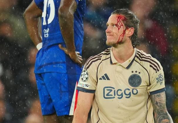 Wout Weghorst of Ajax after an accidental boot in the face from Tosin Adarabioyo of Chelsea Chelsea v Ajax, UEFA Champions League, Group Stage, Football, Stamford Bridge, London, UK - 22 Oct 2025London Stamford Bridge United Kingdom EDITORIAL USE ONLY No use with unauthorised audio, video, data, fixture lists, club league logos or live services. Online in-match use limited to 120 images, no video emulation. No use in betting, games or single club league player publications. Copyright: xJavierxGarcia Shutterstockx 15558807s