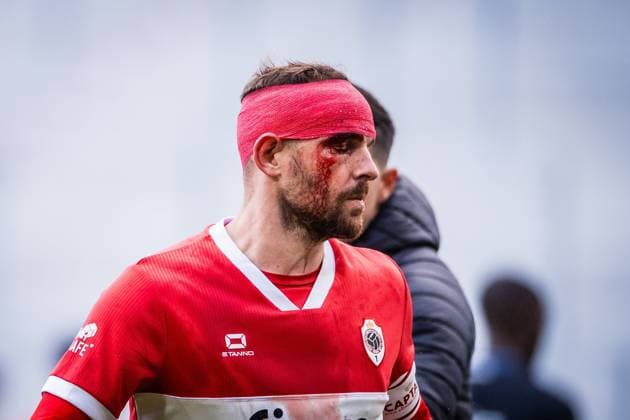 Sport Bilder des Tages Royal Antwerp FC v Club Brugge - Jupiler Pro League DEURNE, BELGIUM - OCTOBER 26 : Janssen Vincent forward of Royal Antwerp FC with an injury to the head during the Jupiler Pro League match between Royal Antwerp FC and Club Brugge on October 26, 2025 in Deurne, Belgium, 26 10 2025 Deurne Belgium  Copyright: xGvgx