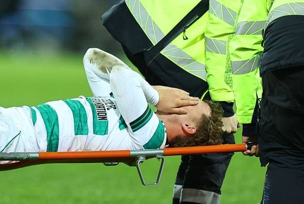 Callum Osmand of Celtic looks injured and is taken off the pitch Midtjylland vs Celtic, UEFA Europa League, Group Stage, Football, MCH Arena, Herning, Denmark - 06 Nov 2025Herning MCH Arena Denmark EDITORIAL USE ONLY No use with unauthorised audio, video, data, fixture lists, club league logos or live services. Online in-match use limited to 120 images, no video emulation. No use in betting, games or single club league player publications.  Copyright: xMichaelxZemanek Shutterstockx 15642247aq
