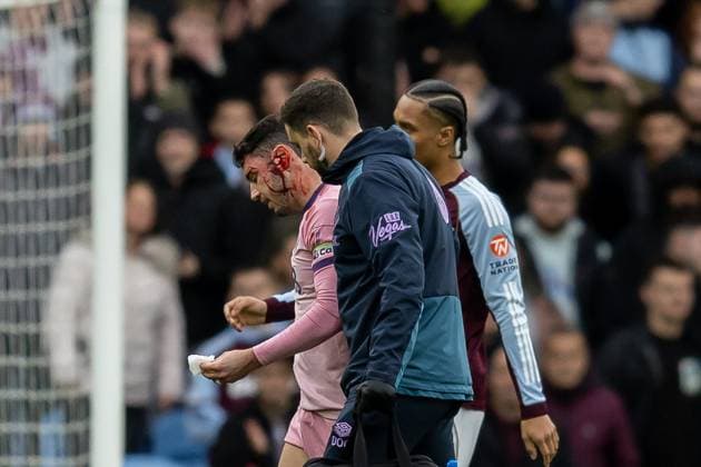 Aston Villa v Bournemouth Premier League 09 11 2025. Bournemouth defender Adam Smith (15) walks off pitch after clash of heads during the Premier League match between Aston Villa and Bournemouth at Villa Park, Birmingham, England on 9 November 2025. Editorial use only DataCo restrictions apply See www.football-dataco.com , Copyright: xManjitxNarotrax PSI-23205-0004