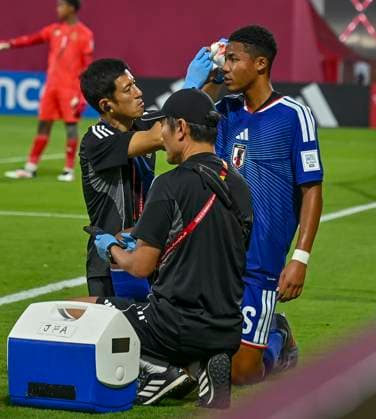 Japan v South Africa: Round of 32- FIFA U-17 World Cup Qatar 2025 Simonyu Mendy of Japan reacts after suffering a head injury and subsequently being substituted off during the FIFA U-17 World Cup Qatar 2025 Round of 32 match between Japan and South Africa in Doha, Qatar, on November 15, 2025. DOHA Qatar Copyright: xNOUSHADxTHEKKAYILx