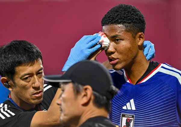 Japan v South Africa: Round of 32- FIFA U-17 World Cup Qatar 2025 Simonyu Mendy of Japan reacts after suffering a head injury and subsequently being substituted off during the FIFA U-17 World Cup Qatar 2025 Round of 32 match between Japan and South Africa in Doha, Qatar, on November 15, 2025. DOHA Qatar Copyright: xNOUSHADxTHEKKAYILx