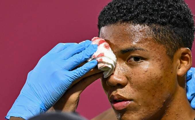 Japan v South Africa: Round of 32- FIFA U-17 World Cup Qatar 2025 Simonyu Mendy of Japan reacts after suffering a head injury and subsequently being substituted off during the FIFA U-17 World Cup Qatar 2025 Round of 32 match between Japan and South Africa in Doha, Qatar, on November 15, 2025. DOHA Qatar Copyright: xNOUSHADxTHEKKAYILx