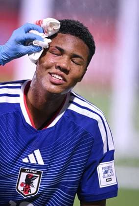 Football, Junior U 17 World Cup 2025 Doha Qatar Round of 16 15 11 2025 Match 82 Japan South Africa Simon Yu Mendy Japan has to be substituted with a laceration to the head