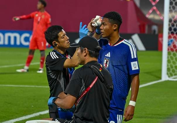 (251116) -- DOHA, Nov. 16, 2025 -- Mendy Simon Yu (R) of Japan receives a medical treatment during the round of 32 football match between Japan and South Africa at FIFA U17, U 17 World cup Qatar 2025 in Doha, Qatar, on Nov. 15, 2025. (Photo by Xinhua) (SP)QATAR-DOHA-FOOTBALL-FIFA U17 WORLD CUP 2025-JAPAN VS SOUTH AFRICA Nikku 