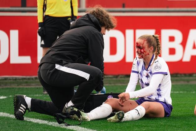 Paula Flach (SGS Essen, 5) getting injured during the Google Pixel Frauen Bundesliga game between Bayer 04 Leverkusen and SGS Essen at Ulrich - Haberland Stadium in Levekusen, Germany  Copyright: xLeoniexKiehlx xSPPx Sportspressphoto_SPR64667