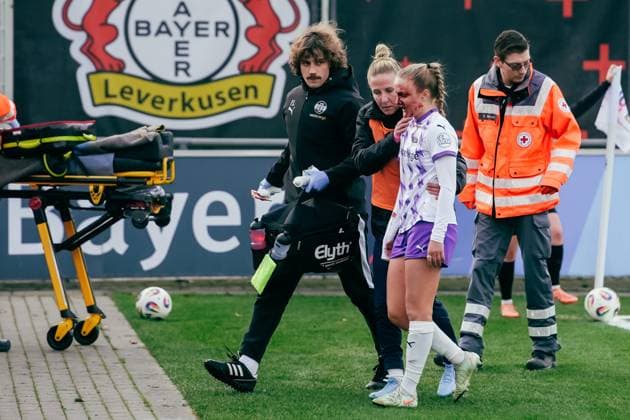 22 11 25, Women, Soccer, Google Pixel Women Bundesliga, Season 2025 2026, Bayer 04 Leverkusen SGS Essen, 11 Matchday Paula Flach 5 SGS Essen Substitution after laceration Leverkusen Ulrich Haberland Stadion NRW Germany