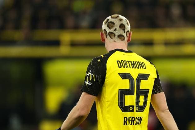 Dortmund, Signal Iduna Park, 22.11.25, GER, Herren, 1. Bundesliga, Saison 2025 - 2026, Borussia Dortmund - VfB Stuttgart, Julian Ryerson (Borussia Dortmund) mit neuer Frisur. DFB DFL REGULATIONS PROHIBIT ANY USE OF PHOTOGRAPHS AS IMAGE SEQUENCES AND OR QUASI-VIDEO. *** Dortmund, Signal Iduna Park, 22 11 25, GER, Men, 1 Bundesliga, Season 2025 2026, Borussia Dortmund VfB Stuttgart, Julian Ryerson Borussia Dortmund with new hairstyle DFB DFL REGULATIONS PROHIBIT ANY USE OF PHOTOGRAPHS AS IMAGE SEQUENCES AND OR QUASI VIDEO Copyright: JoachimxBywaletz xJB-Sportfoto