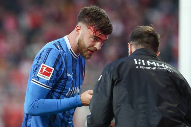 29 11 2025, xtgx, Fußball 1 Bundesliga, 1 FC Union Berlin 1 FC Heidenheim emspor, v l Julian Niehues Heidenheim, 16 , Niklas Dorsch Heidenheim, 30 verletzt, Verletzung, injury, injured, Kopf, Blut, blutet DFL DFB REGULATIONS PROHIBIT ANY USE OF PHOTOGRAPHS as IMAGE SEQUENCES and or QUASI VIDEO Berlin