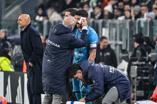 Alessandro Deiola of Cagliari Calcio, Infortunio during Juventus FC vs Cagliari Calcio, Italian soccer Serie A match in Turin, Italy, November 29 2025  Copyright: xLuigixCanu IPAxSportx xipa-agency.netx xx IPA_68517297 IPA_Agency_IPA68517297