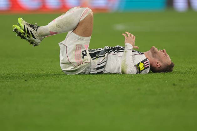 Turin, Italy, 2nd December 2025. Teun Koopmeiners of Juventus reacts after landing awkwardly on his shoulder during the Juventus vs Udinese Coppa Italia match at Allianz Stadium, Turin. Picture credit should read: Jonathan Moscrop Sportimage EDITORIAL USE ONLY. No use with unauthorised audio, video, data, fixture lists, club league logos or live services. Online in-match use limited to 120 images, no video emulation. No use in betting, games or single club league player publications. SPI_041_JM_JUVE_UDINESE_CI SPI-4319-0041