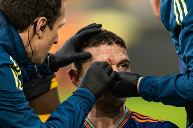 18th January 2026; Molineux Stadium, Wolverhampton, West Midlands, England; Premier League Football, Wolverhampton Wanderers versus Newcastle United; Kieran Trippier of Newcastle United receives treatment for a gash on his head following a tackle  GodfreyxPitt