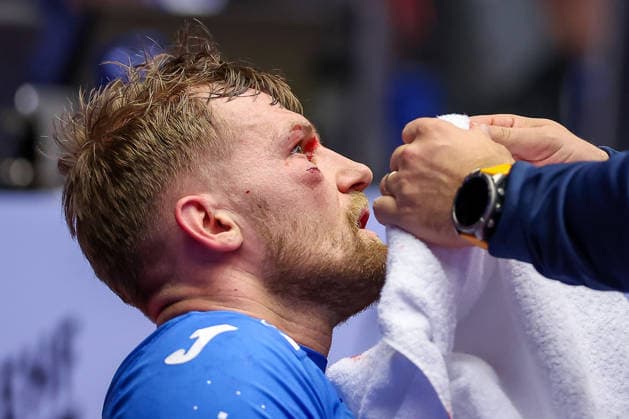 01 02 2026, Handball, Men s EHF EURO 2026, Iceland Croatia, Jyske Bank Boxing in Herning, Denmark, Placement Match 3 4 David Mandic Croatia 39 needs medical treatment for a laceration to the face Denmark