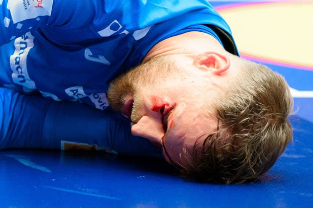 Herning Handball EM 2026 Match 3rd place Iceland Croatia David Mandic Croatia Injured Injury Pain, cut on eye, blood Herning Jyske Bank Boxing Denmark