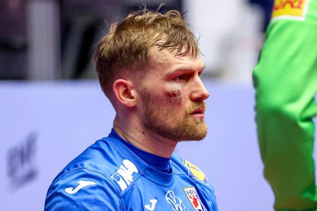 01 02 2026, Handball, Men s EHF EURO 2026, Iceland Croatia, Jyske Bank Boxing in Herning, Denmark, Placement Match 3 4 David Mandic Croatia 39 with stapled wound in the face on the bench Denmark