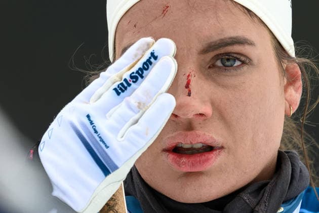 260209 Kristine Stavas Skistad of Norway at a cross-country skiing training session during day 3 of the 2026 Winter Olympics on February 9, 2026 in Val di Fiemme. Photo: Maxim Thore BILDBYRAN kod MT MT0966 skidor cross-country skiing langrenn Olympic Games, Olympische Spiele, Olympia, OS olympics winter olympics os ol olympiska spel vinter-os olympiske leker milano cortina 2026 milan cortina 2026 milano cortina 2026 olympic games milano cortina 2026 winter olympic games milano cortina-os milano cortina-ol vinter-ol 3 bbeng träning norge *** 260209 Kristine Stavas Skistad of Norway at a cross country skiing training session during day 3 of the 2026 Winter Olympics on February 9, 2026 in Val di Fiemme Photo Maxim Thore BILDBYRAN kod MT MT0966 skidor cross country skiing langrenn olympic games olympics winter olympics os ol olympiska spel vinter os olympiske leker milano cortina 2026 milan cortina 2026 milano cortina 2026 olympic games milano cortina 2026 winter olympic games milano cortina os milano cortina ol vinter ol 3 bbeng träning norge  Copyright: MAXIMxTHORE BB260209MT023