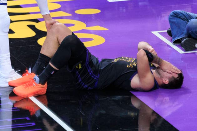 February 24, 2026, Los Angeles, California, USA: Luka Doncic 77 of the Los Angeles Lakers recoils in pain after being poked in the eye during their regular season NBA, Basketball Herren, USA game against the Orlando Magic on Tuesday February 24, 2026 at Crypto.com Arena in Los Angeles, California. ARIANA RUIZ PI Lakers Vs. Magic  - ZUMAp124 20260224_zaa_p124_004 Copyright: xArianaxRuizx