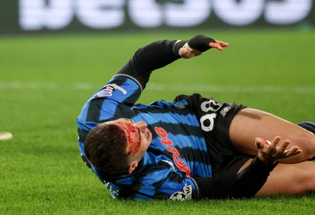 Foto IPP Roberto Bregani Bergamo 25-02-2026 Calcio UEFA Champions League 2025 2026, Atalanta vs Borussia Dortmund Nella foto Nikola Krstovic dell Atalanta ferito dopo il contatto con Rami Bensebain del Borussia Dortmund. Italy Photo Press World Copyright. italy ITALY  Copyright: xR4924_italyphotopressx