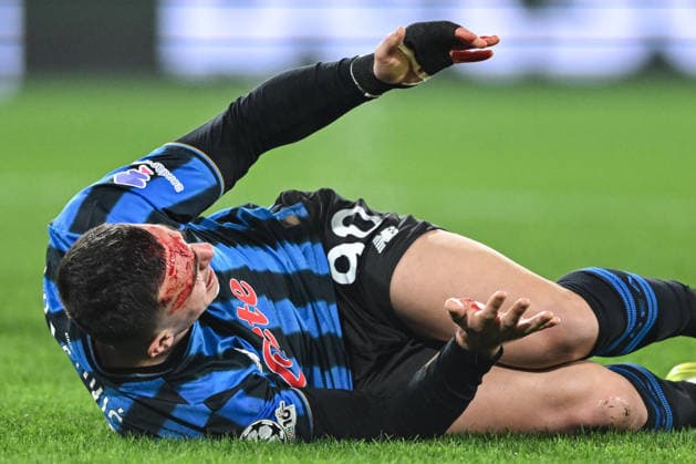 Atalanta BC v Borussia Dortmund - UEFA Champions League 2025 26 League Knockout Play-off Second Leg Nikola Krstovic of Atalanta BC sustains an injury during the UEFA Champions League 2025 2026 Knockout Play-off Second Leg between Atalanta BC and Borussia Dortmund in Bergamo, Italy, on February 25, 2026, at New Balance Arena stadium Bergamo Italy  Copyright: xTizianoxBallabiox originalFilename:ballabio-atalanta260225_npaFO.jpg