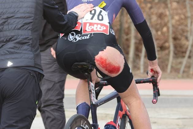 Fenix - Ekoï Omloop van het Hageland AARSCHOT TIELT - WINGE, Belgium 01 03 2026 Rondel Lea (FRA) of Mayenne Monbana My Pie injury Pictured during the Fenix - Ekoï Omloop van het Hageland on 01 March 2026 ( Picture by Gianni Barbieux Photo News ). Gent Belgium  Copyright: xGiannixBarbieuxx