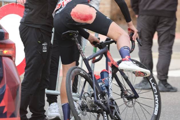 Fenix - Ekoï Omloop van het Hageland AARSCHOT TIELT - WINGE, Belgium 01 03 2026 Rondel Lea (FRA) of Mayenne Monbana My Pie injury Pictured during the Fenix - Ekoï Omloop van het Hageland on 01 March 2026 ( Picture by Gianni Barbieux Photo News ). Gent Belgium  Copyright: xGiannixBarbieuxx