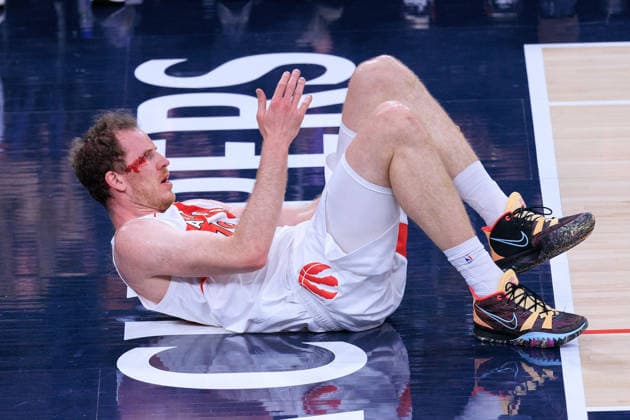 March 25, 2026, Inglewood, California, USA: Jakob Poeltl 19 of the Toronto Raptors bleeds after being stroke to the side of the right eye during a regular season NBA, Basketball Herren, USA game against the Los Angeles Clippers on Wednesday March 25, 2026 at Intuit Dome Arena in Inglewood, California. JAVIER ROJAS PI. Clippers Vs. Raptors  - ZUMAp124 20260325_zaa_p124_005 Copyright: xJavierxRojasx