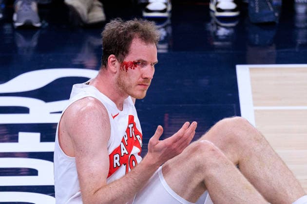 March 25, 2026, Inglewood, California, USA: Jakob Poeltl 19 of the Toronto Raptors bleeds after being stroke to the side of the right eye during a regular season NBA, Basketball Herren, USA game against the Los Angeles Clippers on Wednesday March 25, 2026 at Intuit Dome Arena in Inglewood, California. JAVIER ROJAS PI. Clippers Vs. Raptors  - ZUMAp124 20260325_zaa_p124_006 Copyright: xJavierxRojasx