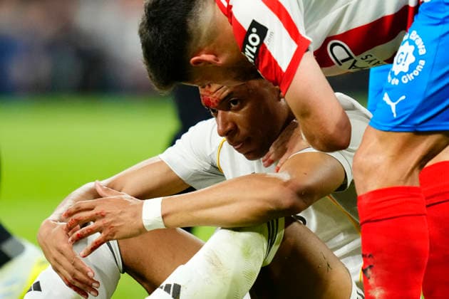 Real Madrid CF v Girona FC - LaLiga EA Sports Kylian Mbappe centre-forward of Real Madrid and France lies injured on the pitch during the La Liga EA Sports match between Real Madrid CF and Girona FC at Estadio Santiago Bernabeu on April 10, 2026 in Madrid, Spain. Madrid Spain  Copyright: xJosexBretonx originalFilename:bretonhernandez-realmadr260410_nprqe.jpg