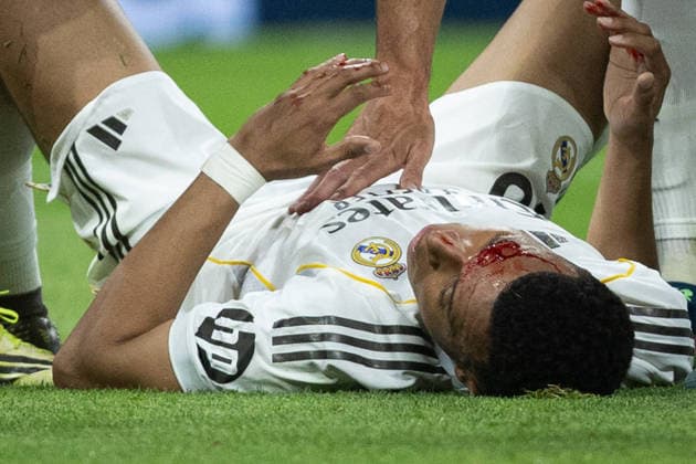 April 10, 2026, Madrid, Madrid, Spain: Kylian Mbappe of Real Madrid CF during La Liga football match between Real Madrid CF and Girona at Santiago Bernabeu Stadium in Madrid, Spain, April 10, 2026 Soccer 2026: Real Madrid CF Vs Girona  - ZUMAa206 20260410_zsp_a206_135 Copyright: xRubenxAlbarranx