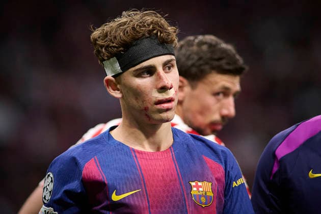 Atletico de Madrid v FC Barcelona, Barca - UEFA Champions League 2025 2026 - Quarter-final, 2nd leg FC Barcelona™s -Fermin Lopez injured during Champions League 2025 2026, quarter-final, 2nd leg, April 14 ,2026. (ALTERPHOTOS Ropero) MadridSpain  Copyright: xRoperox
