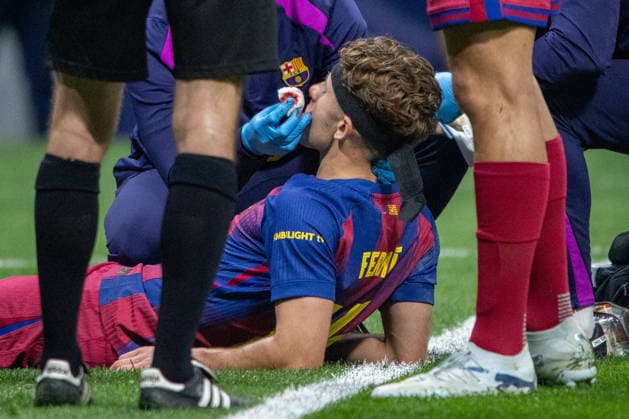 April 14, 2026, Madrid, Spain: Fermin Lopez of FC Barcelona, Barca is attended to by the medical staff during the UEFA Champions League quarter-final second leg match between AtlÃ tico de Madrid and FC Barcelona played at the Riyadh Air Metropolitano Stadium. Final score: AtlÃ tico de Madrid 1 - 2 FC Barcelona. Madrid Spain - ZUMAs197 20260414_aaa_s197_159 Copyright: xDavidxCanalesx