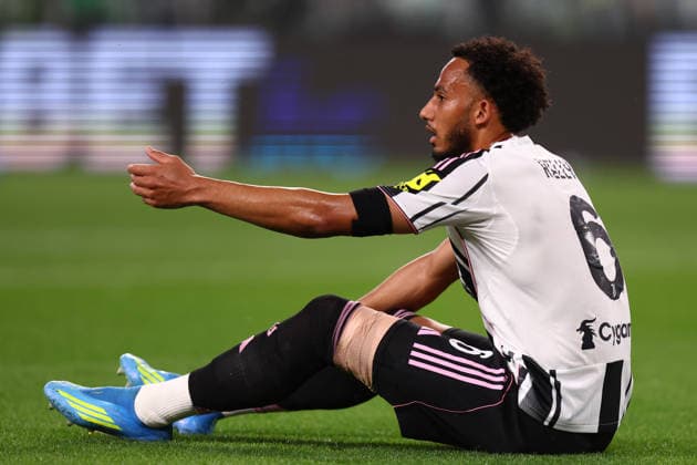 Juventus Fc - Bologna FC Lloyd Kelly of Juventus Fc lies on the ground during the Serie A match beetween Juventus Fc and Bologna FC at Allianz Stadium on April 19, 2026 in Turin, Italy . Torino Allianz Stadium Italy Copyright: xMarcoxCanonierox