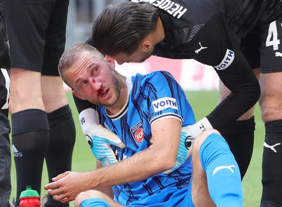 02.05.2026, 1.Bundesliga, FC Bayern Muenchen vs FC Heidenheim, Allianz Arena, Muenchen, Fussball, im Bild: Jonas Foehrenbach (FC Heidenheim) KO schwer verletzt und Diant Ramaj (1.FC Heidenheim) *** 02 05 2026, 1 Bundesliga, FC Bayern Muenchen vs FC Heidenheim, Allianz Arena, Muenchen, Soccer, Sport, in the picture Jonas Foehrenbach FC Heidenheim KO seriously injured and Diant Ramaj 1 FC Heidenheim