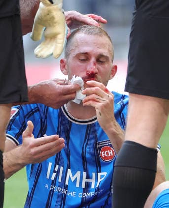 02.05.2026, 1.Bundesliga, FC Bayern Muenchen vs FC Heidenheim, Allianz Arena, Muenchen, Fussball, im Bild: Jonas Foehrenbach (FC Heidenheim) schwer ins Gesicht verletzt *** 02 05 2026, 1 Bundesliga, FC Bayern Muenchen vs FC Heidenheim, Allianz Arena, Muenchen, Football, Sport, in the picture Jonas Foehrenbach FC Heidenheim seriously injured in the face