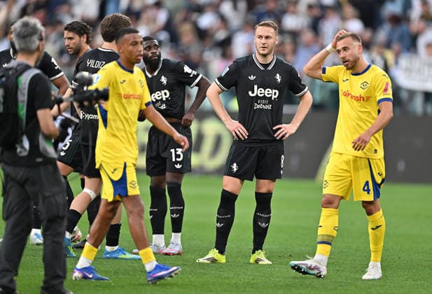 Foto IPP Massimo Rana Torino 03 05 2026 Calcio Campionato di Serie A 2025 2026 Juventus-Hellas Verona 1-1 nella foto Teun Koopmeiners deluso Italy Photo Press Worldwide Copyright italy ITALY  Copyright: xR4924_italyphotopressx