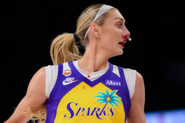 May 24, 2026, Las Vegas, Nevada, USA: CAMERON BRINK 22 of The Los Angels Sparks returned to play with nose plugs after taking a hard hit to the face during WNBA, Basketball Damen, USA regular-season game at Michelob ULTRA Arena in Las Vegas. WNBA 2026: Los Angeles Sparks 101-95 Las Vegas Aces  - ZUMAo117 20260524_zsp_o117_004 Copyright: xMikaelxOnax