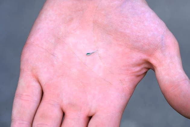 Metal splinters on a hand At the Ironman Hamburg sporting event, there were numerous breakdowns on the bike course because metal splinters were scattered by unknown persons on a road in Kirchwerder, Kirchwerder, Hamburg, Germany Hamburg Kirchwerder Hamburg Germany FOR EDITORIAL PURPOSES ONLY EDITORIAL USE ONLY