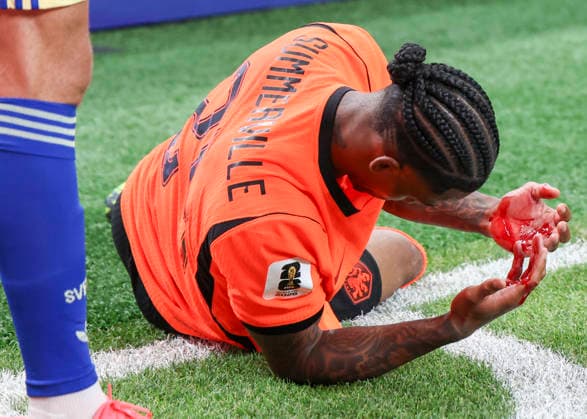 HOUSTON, TX - JUNE 20: Crysencio Summerville 24 of Netherlands looks at his bloody hands after begin hit in the face by Besfort Zeneli 22 of Sweden (not pictured) in the second half during the FIFA World Cup, WM, Weltmeisterschaft, Fussball 2026 Group F match between Netherlands and Sweden on June 20, 2026 at Houston Stadium in Houston, Texas.(Photo by Leslie Plaza Johnson Icon Sportswire) SOCCER: JUN 20 FIFA World Cup 26 Group F - Netherlands vs Sweden EDITORIAL USE ONLY Icon260620011