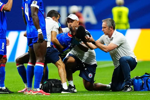 Morocco v Haiti - FIFA World Cup, WM, Weltmeisterschaft, Fussball 2026 - Group C ATLANTA, USA - JUNE 24: Carlens Arcus of Haiti receives medical treatment after injury during 2026 FIFA World Cup First Stage Group C match between Morocco and Haiti at Mercedes-Benz Stadium (Atlanta Stadium) in Atlanta, Georgia, United States on June 24, 2026. Evrim Aydin Anadolu Georgia United States. Editorial use only. Please get in touch for any other usage.  Copyright: x2026xAnadoluxEvrimxAydinx